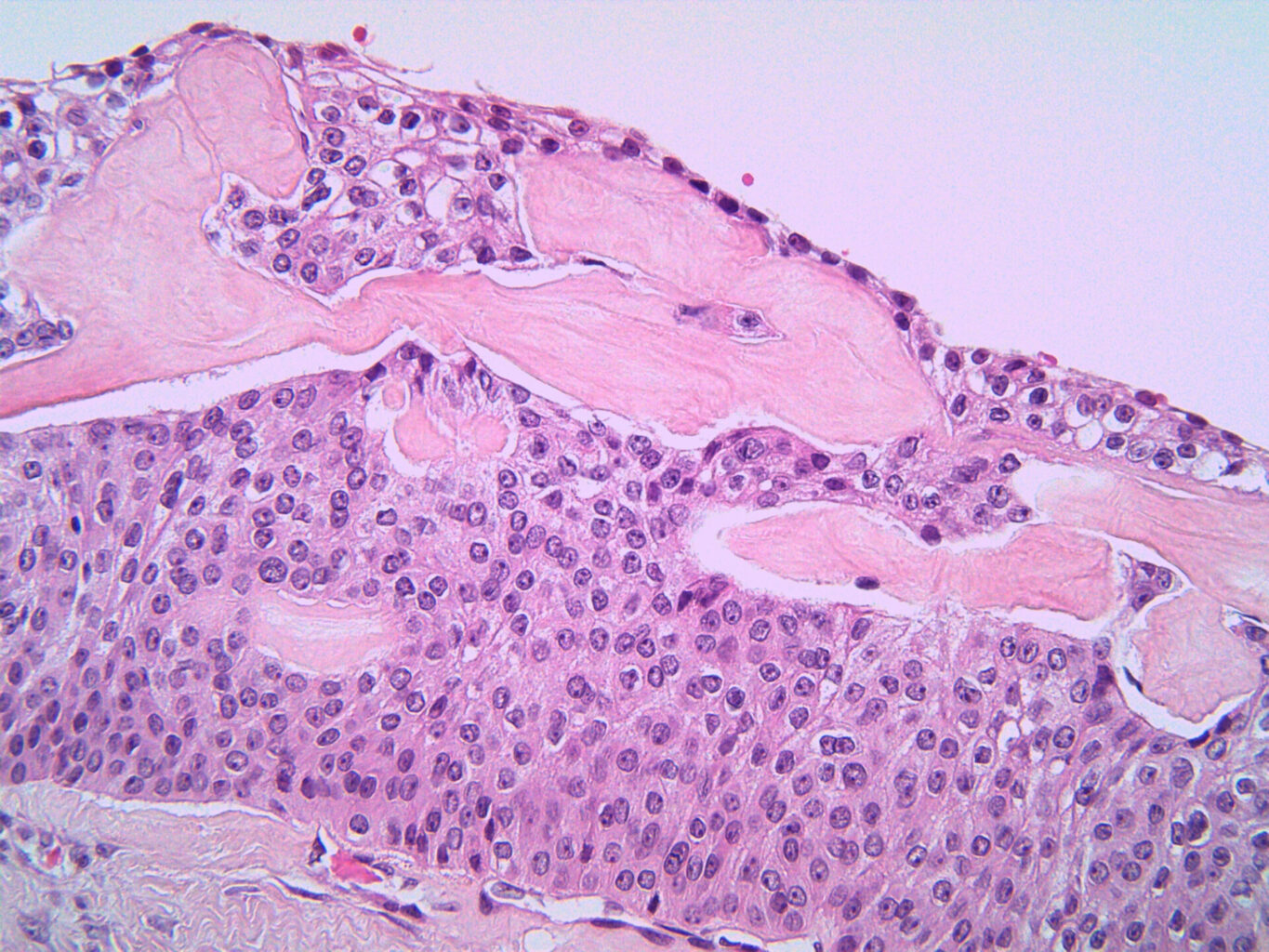 Situational Assessment and Strategic Intelligence of Cell Therapy Landscape in Solid Tumors